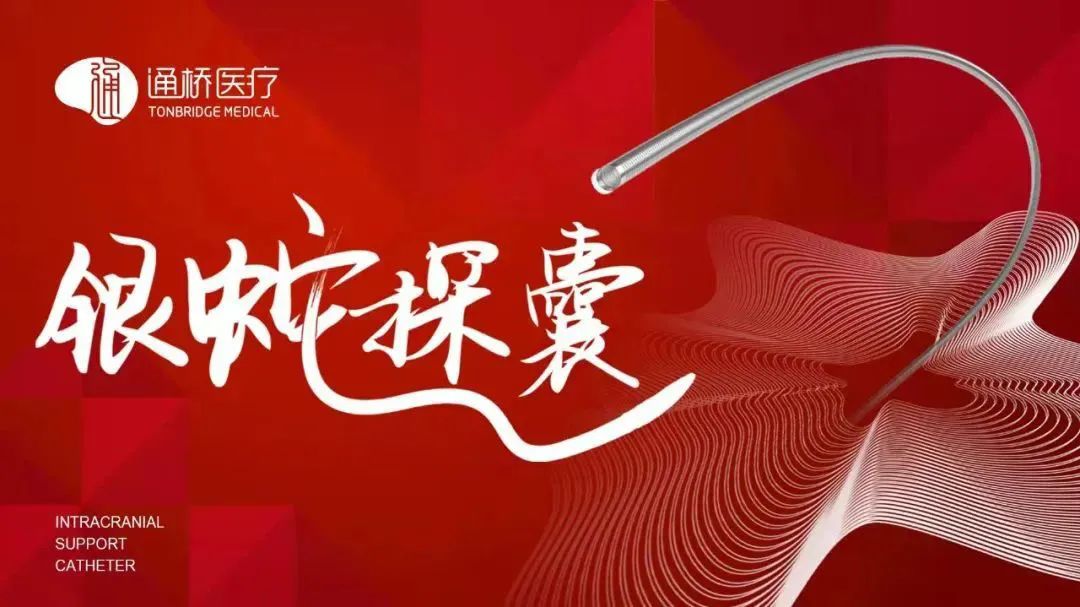 【通桥·银蛇探囊】左侧颈内动脉眼动脉段动脉瘤血流导向装置植入术+弹簧圈栓塞术