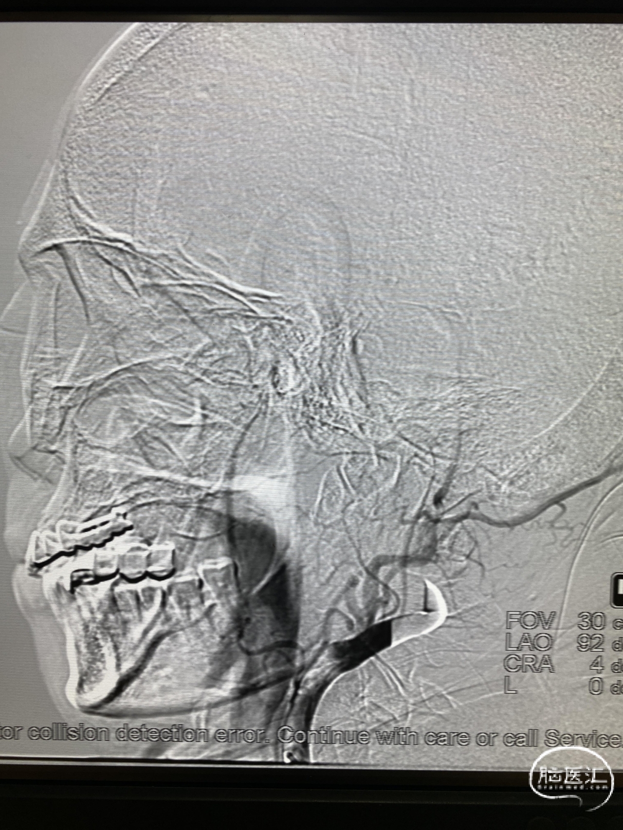 acc4131239b0001b7dd092793eb2290.jpg