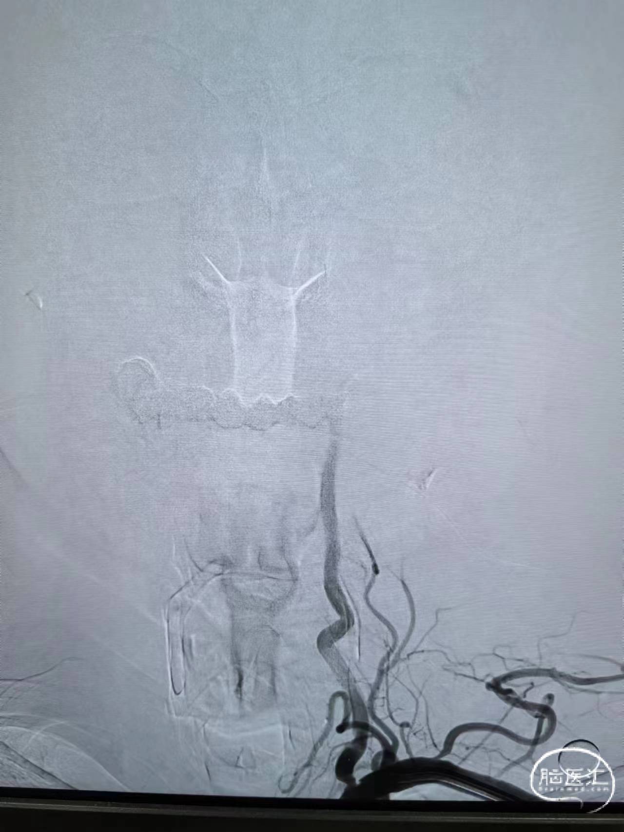 678eec9a74e402a7296ab8d3bd61d2e6_.jpg
