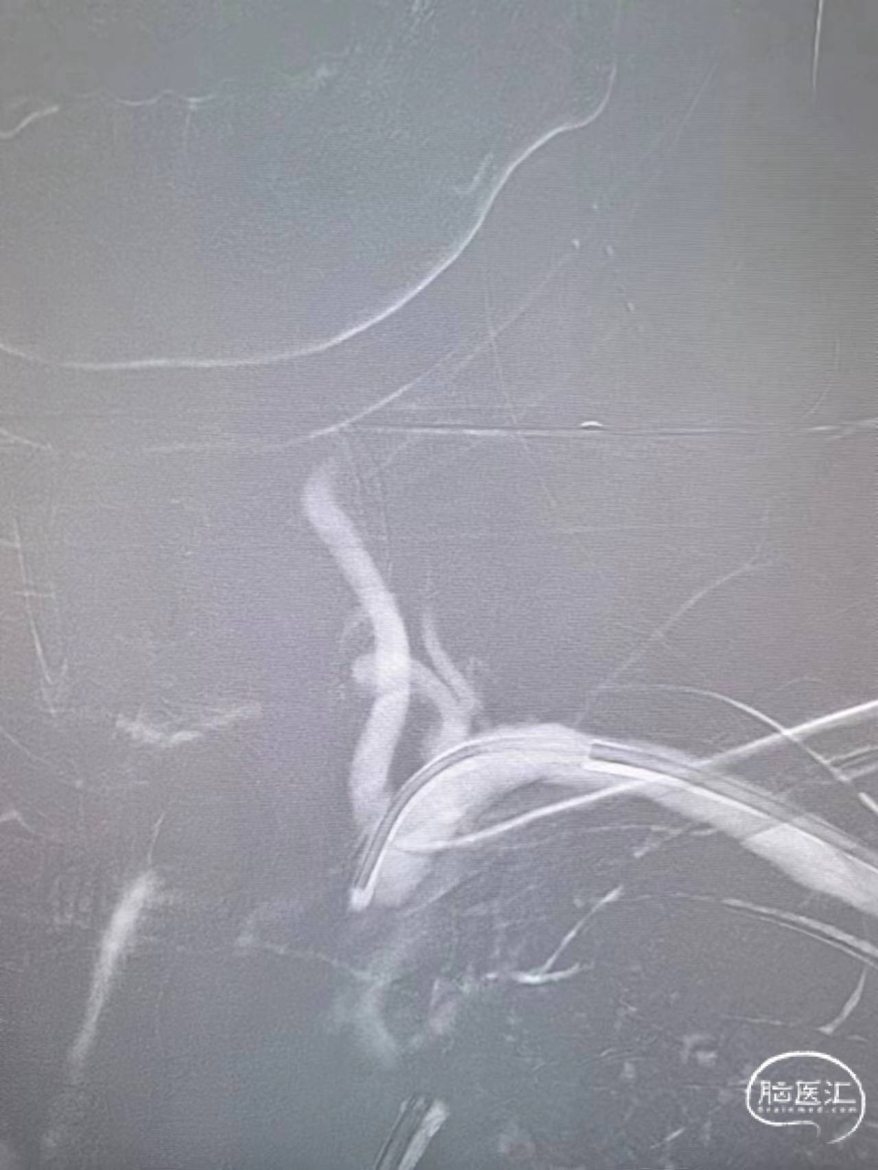 4f968f1a63e8c2b737e4d1a74c349f36_.jpg
