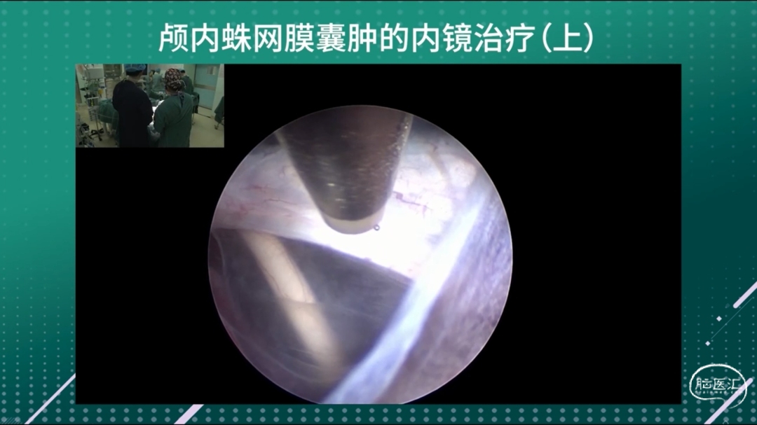 微信截图_20240112185126.png