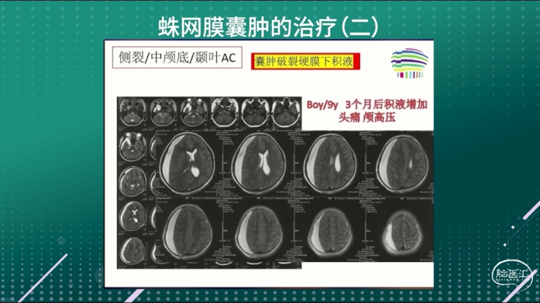 微信截图_20240112183100.png