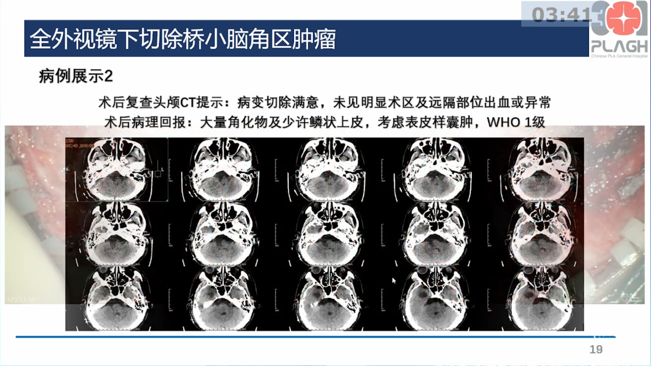 序列 01670.png