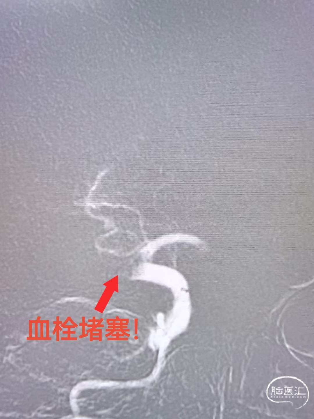 d2d0ab68c2656485f5ab551e5f35e7a8.jpg