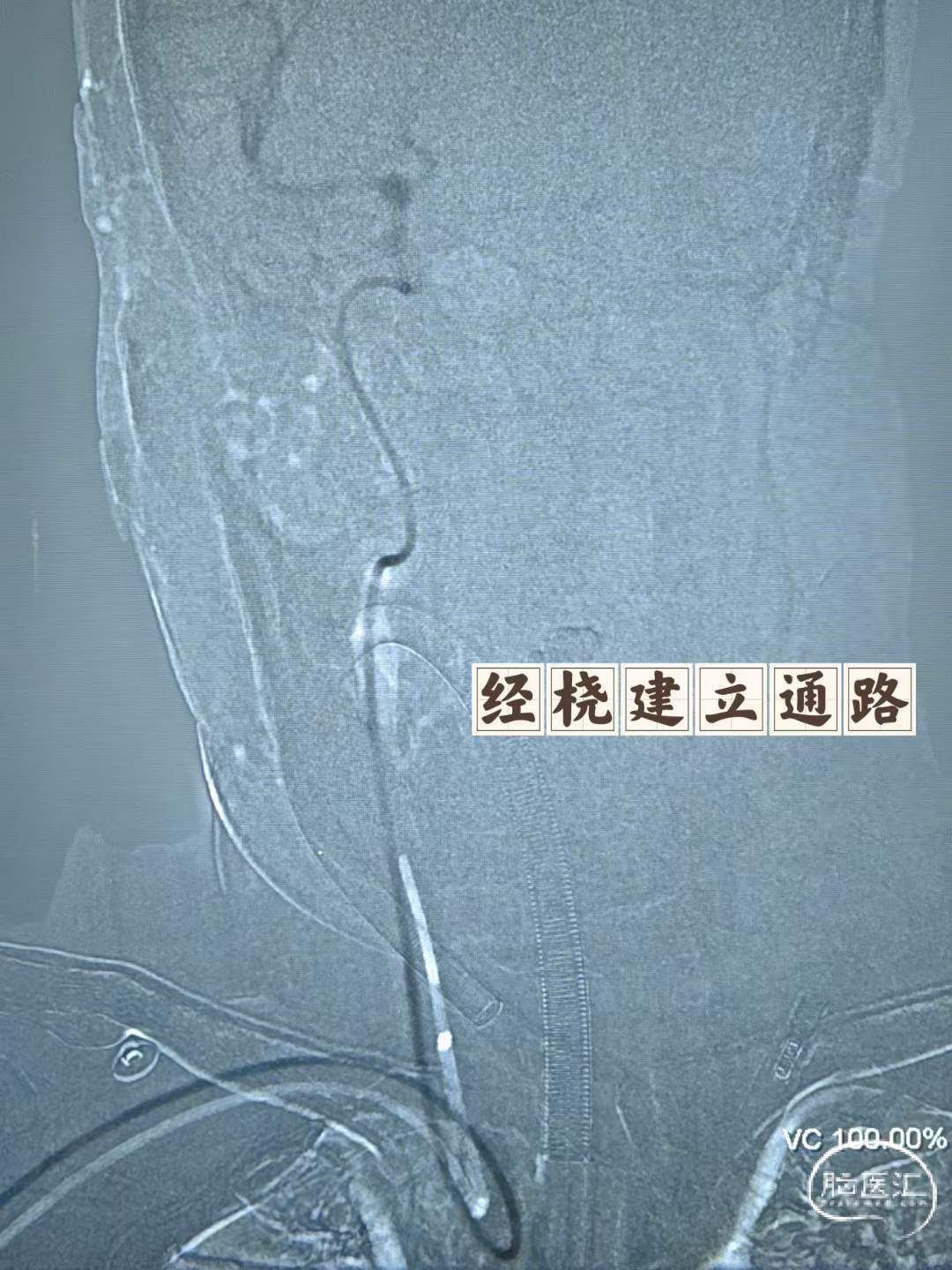 a8bdd27b688ac7b89243ffc3d62486cf.jpg