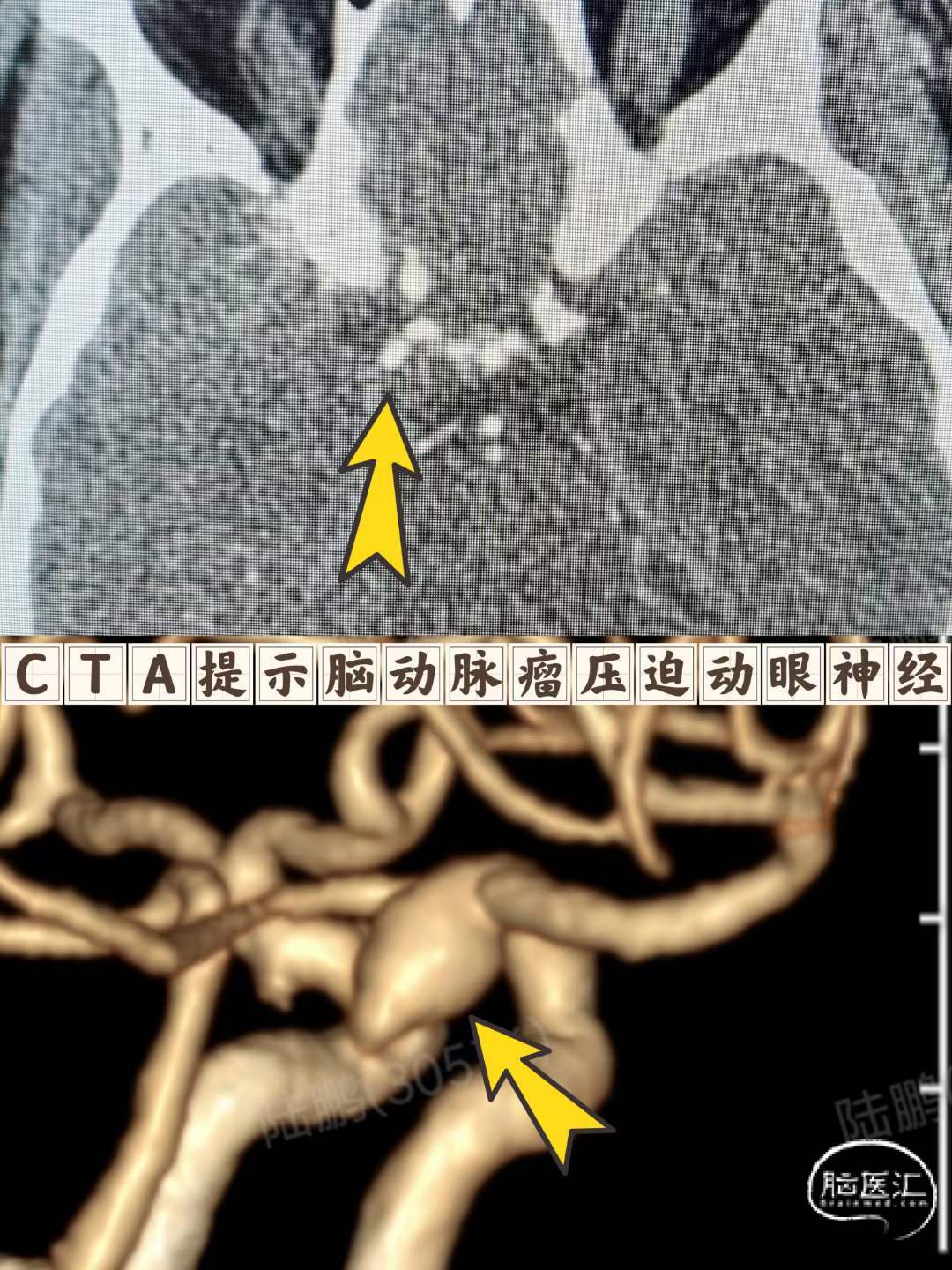ed5a15e927b2687ca76dbf26a1095785.jpg