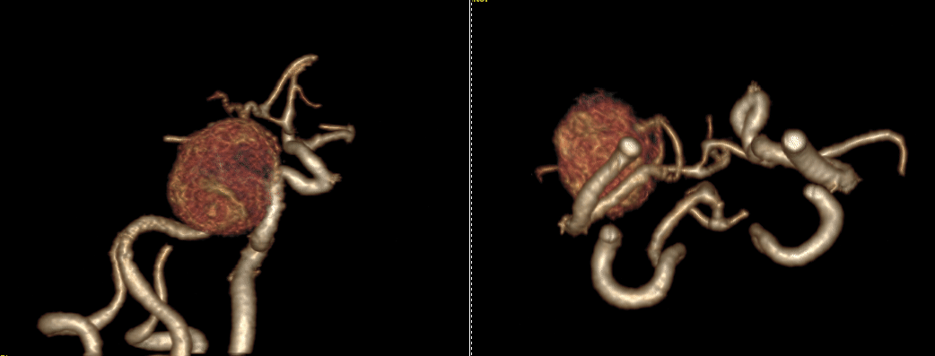 image5.GIF