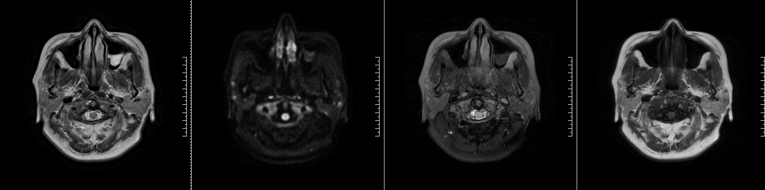 image4.GIF