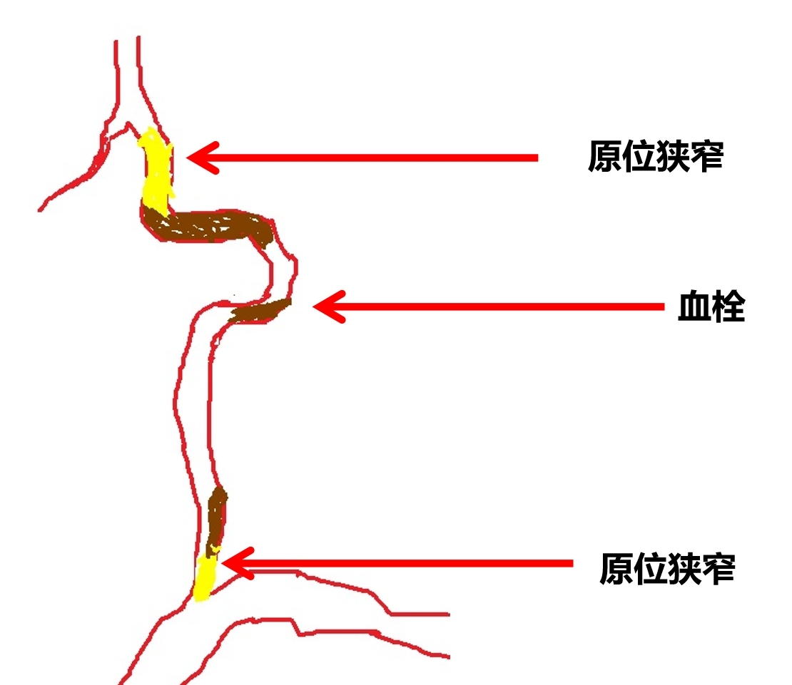 6.png