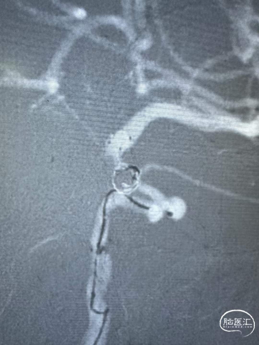 93fca86e1859e33f9a0b50c1e992d070.jpg