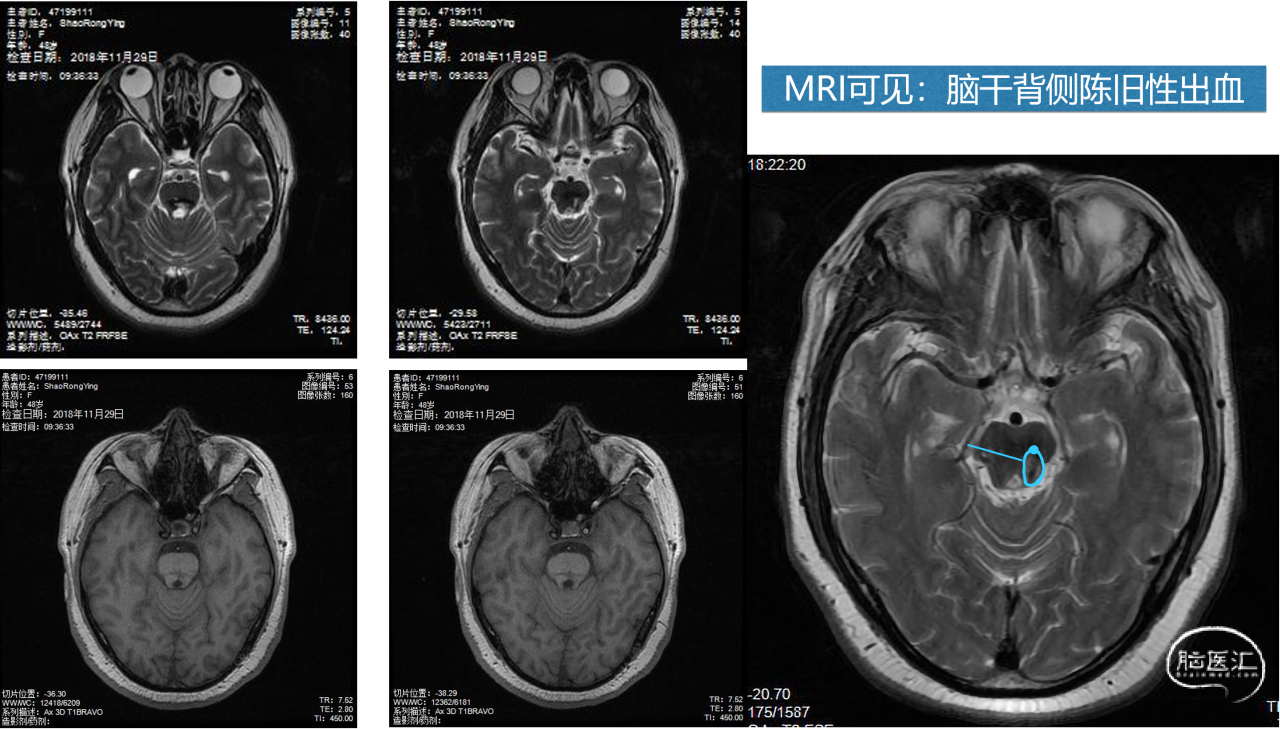 案例2图片1.png