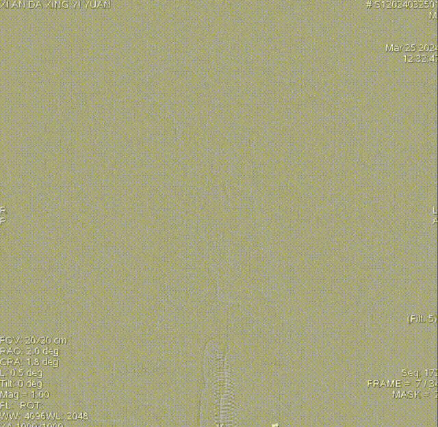 正位 00_00_00-00_00_30.gif
