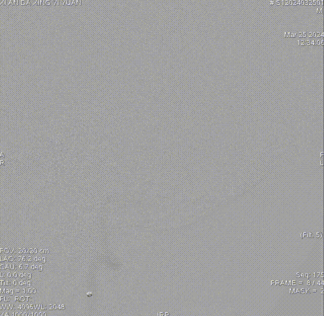 侧位 00_00_00-00_00_30.gif