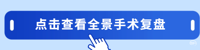 全景手术.png