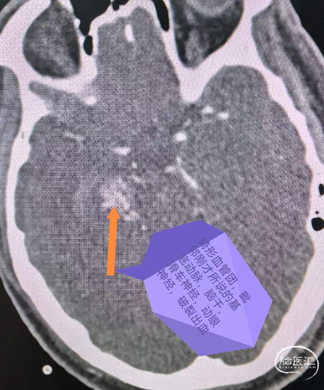 771b8ef1495fff4642745d6785149929.jpg
