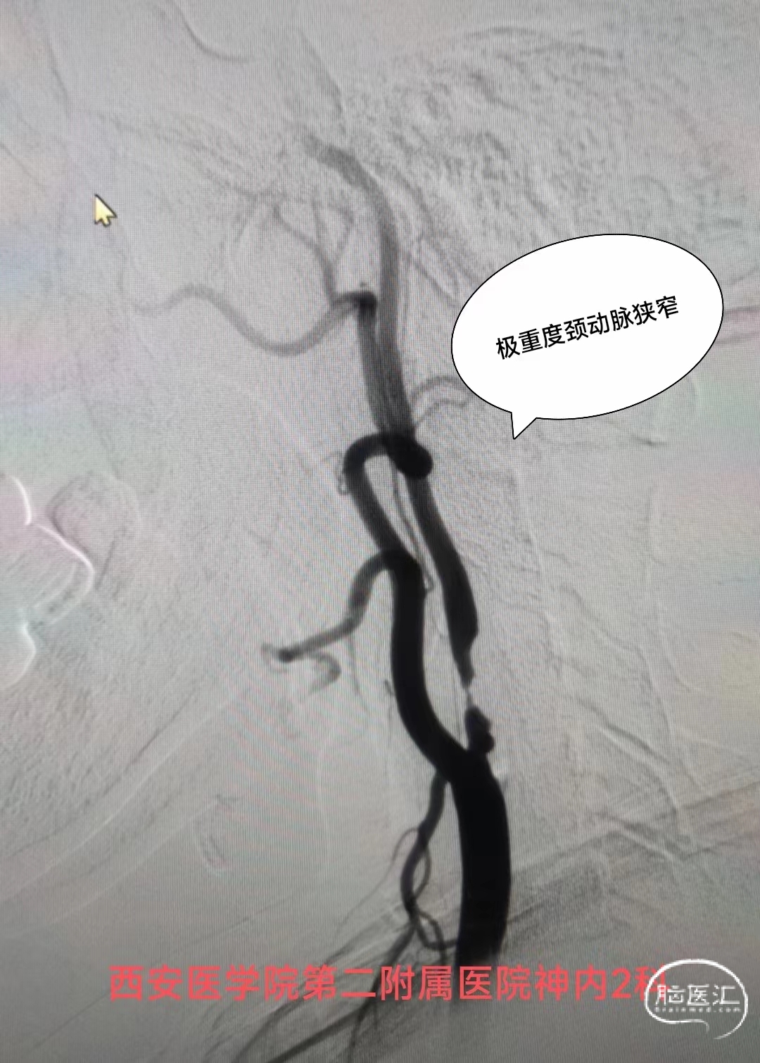 4af73a1091559e8fb64826ca565192f.jpg