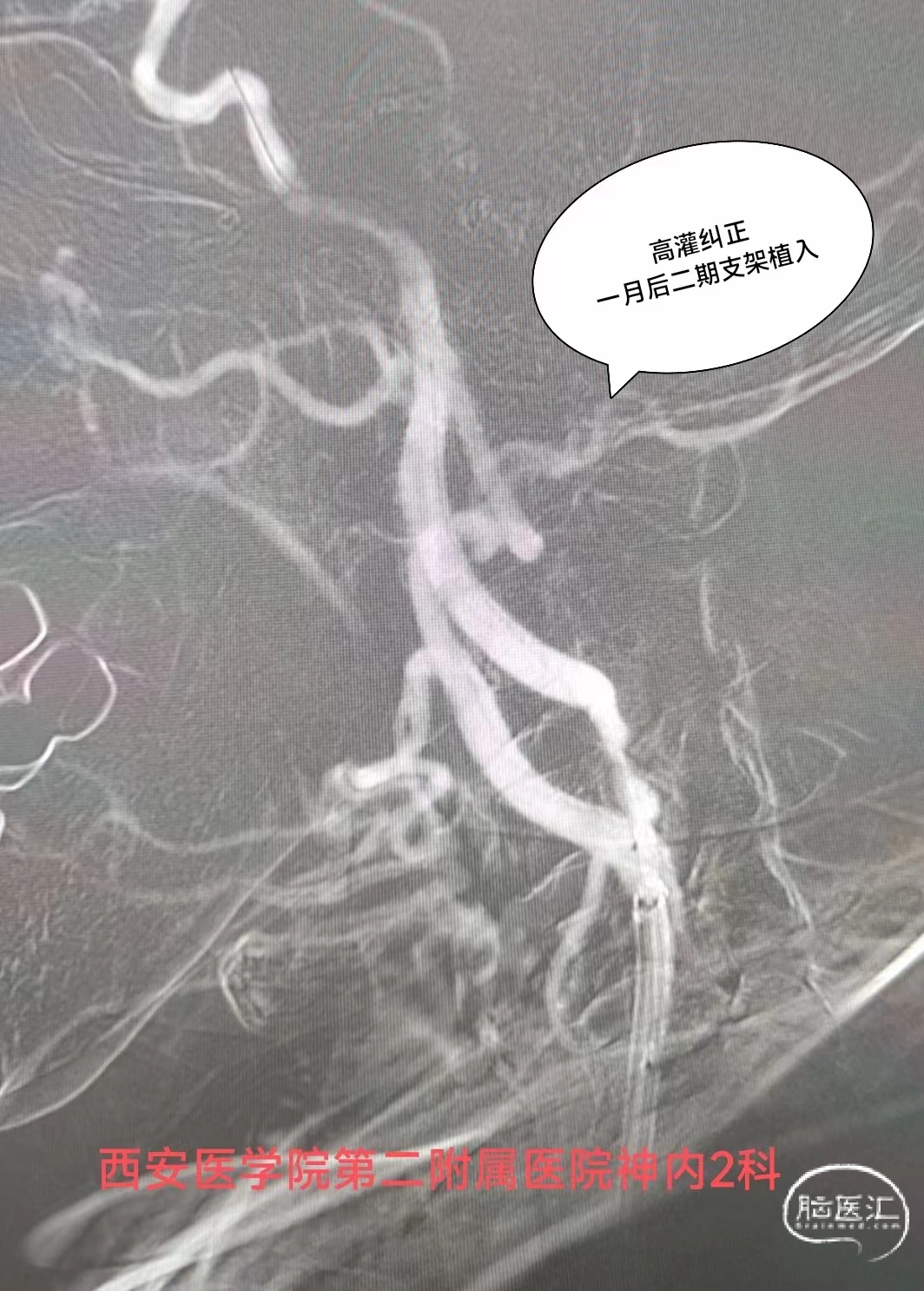 cd612d483e6eb4721b5714863a506f0.jpg