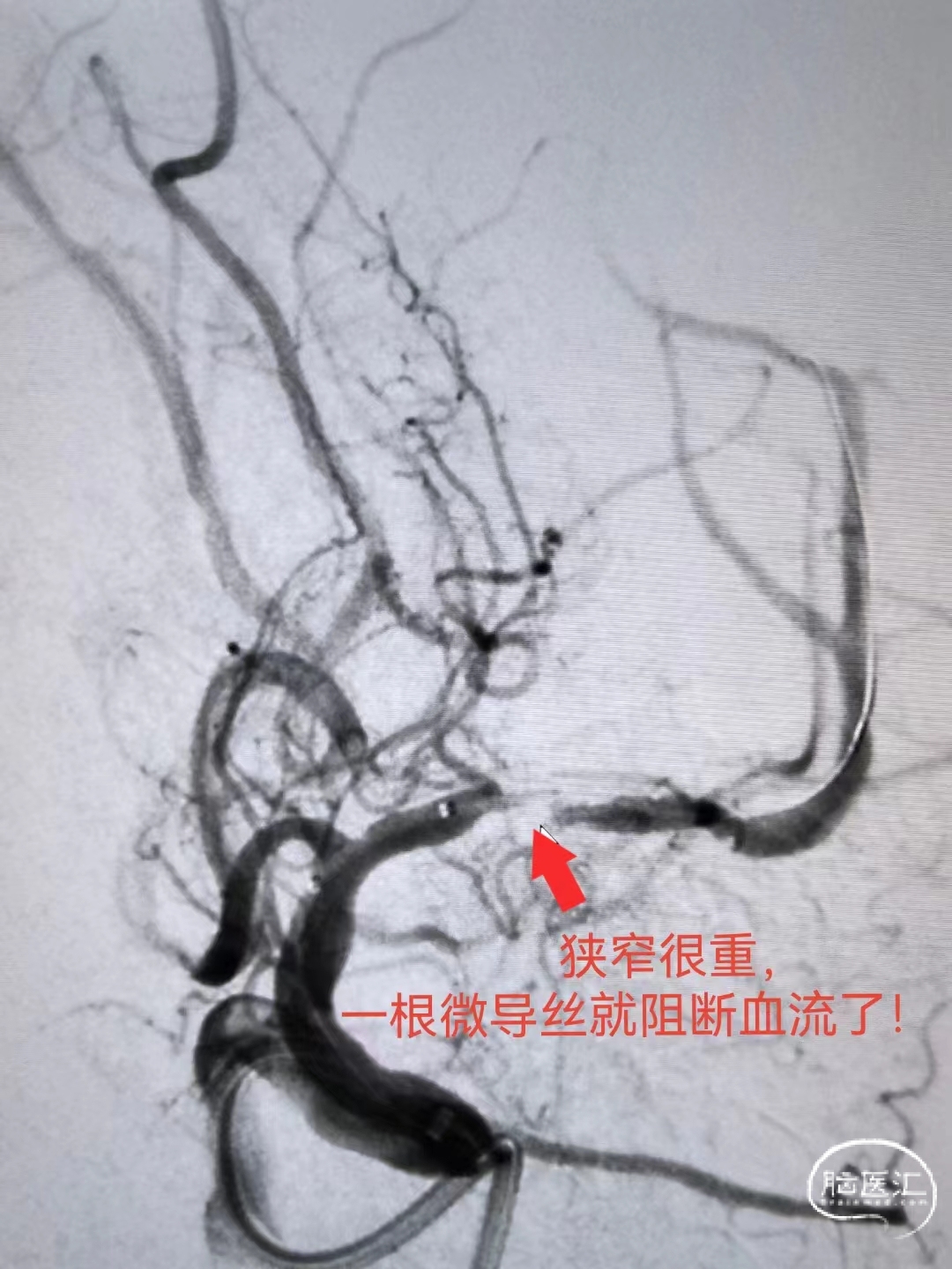 3dbd1bf2fca0a7807c5a6e1b6f3746a.jpg