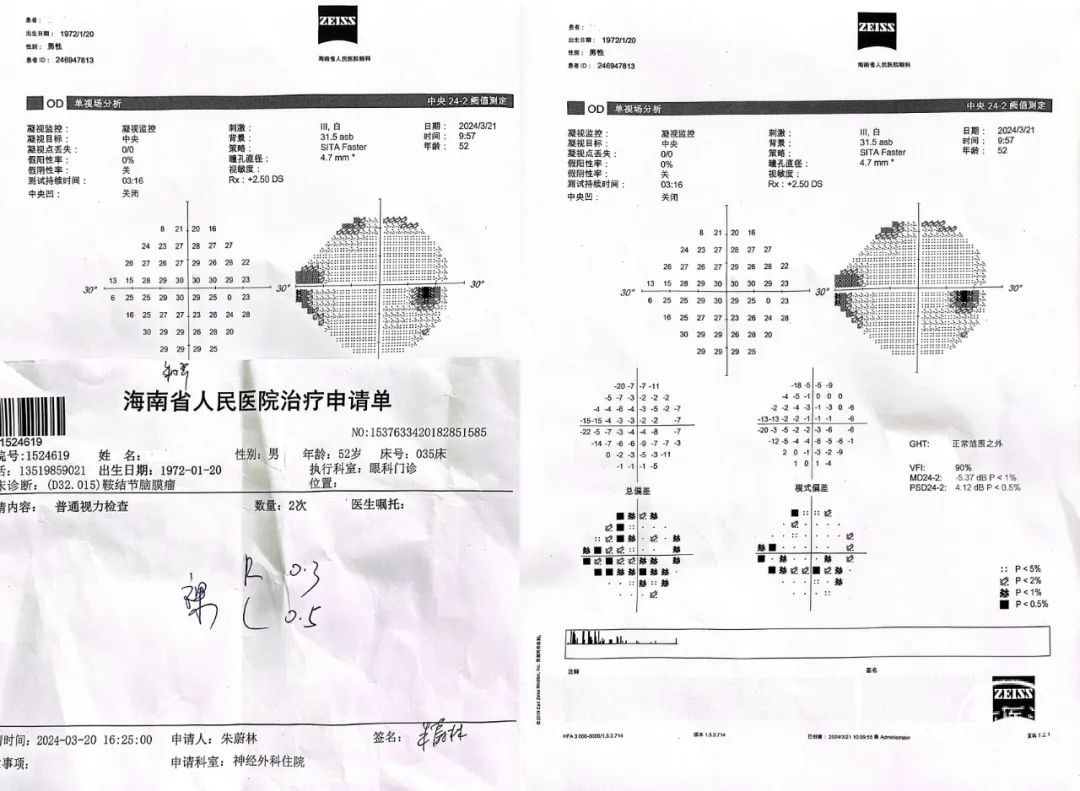 【监测有道】1例鞍结节-鞍膈脑膜瘤神经内镜下手术切除——颅脑创伤-神经重症周刊(第369期) - 脑医汇
