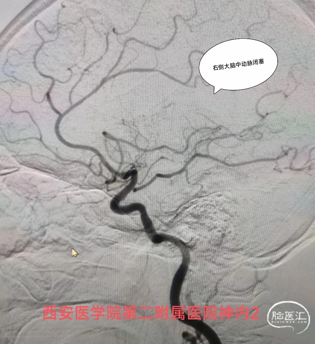 0ac3ca07a6f454ebe38f8a424e9c12b.jpg