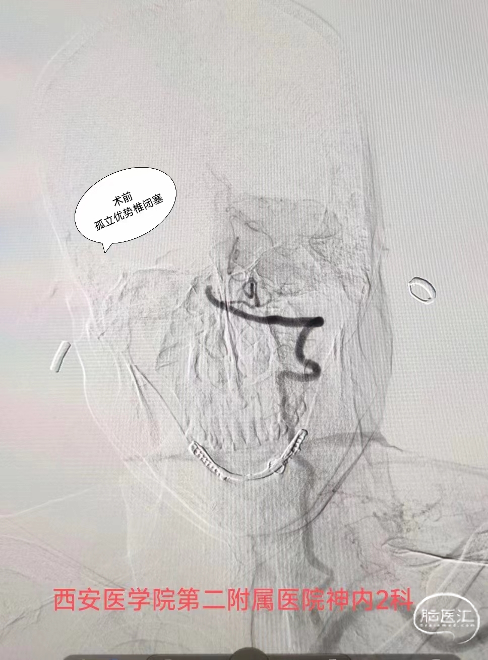 8b55812e457b6b8e27609b35099bd16.jpg