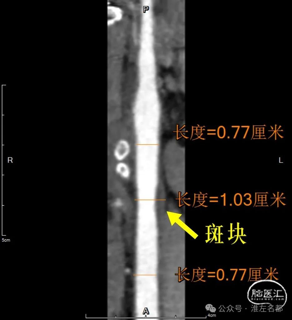 f13b514cf893aa0896877b01baea3737.jpg