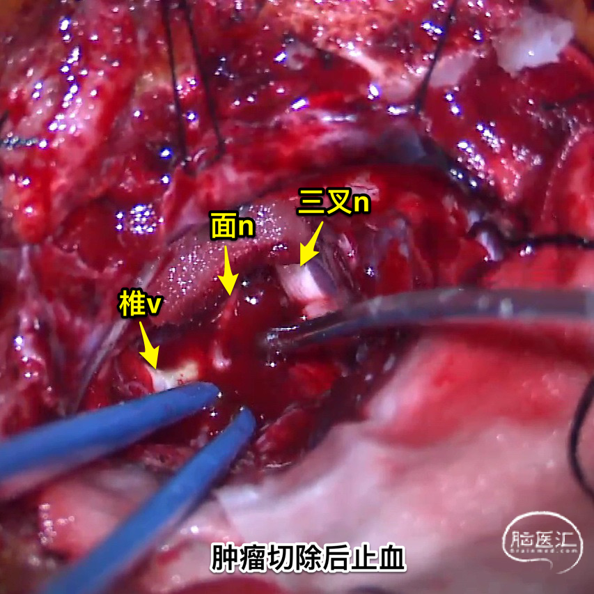 c9c286080d44eccc78cf735cbc016b7b_.png