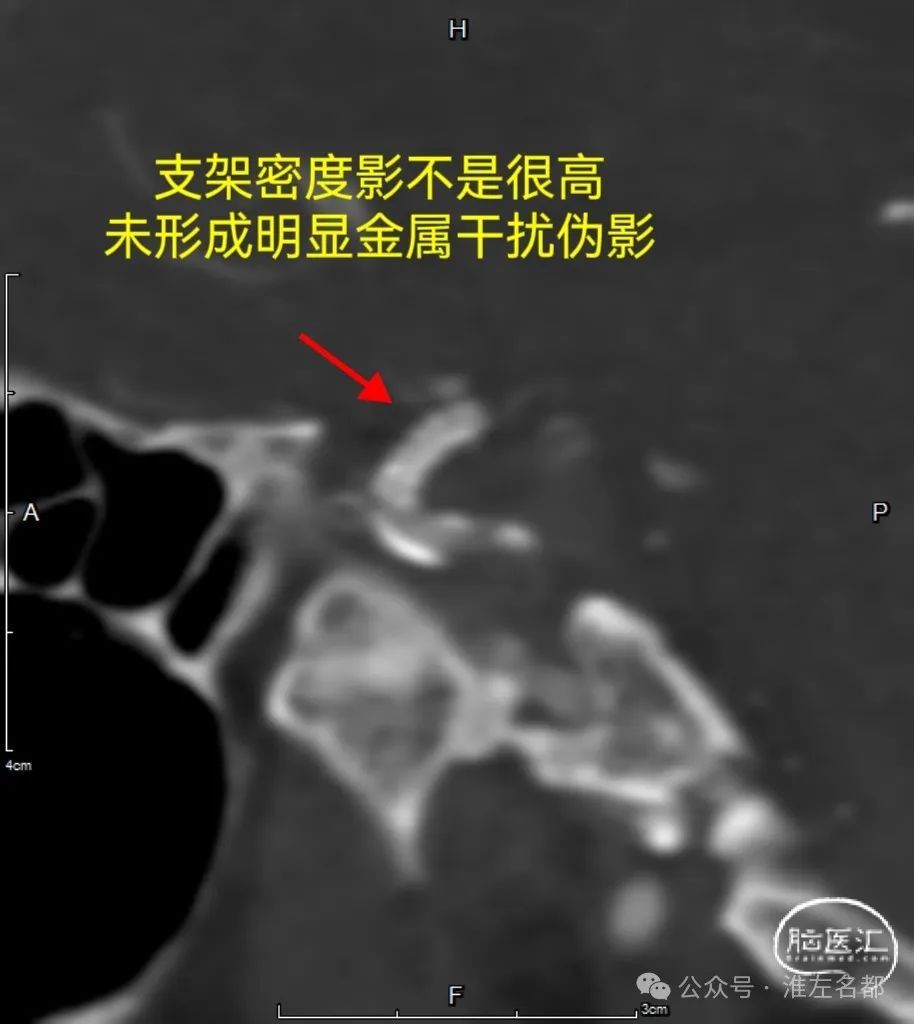 680e4036b9606db1a8074e308a8c7eee.jpg