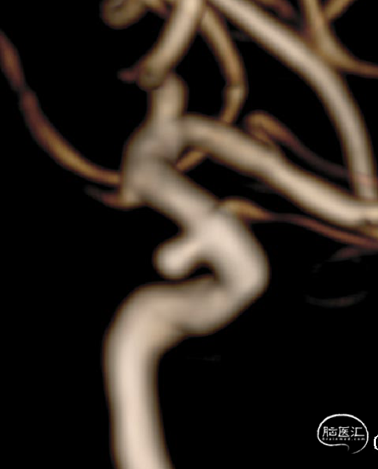 cd28187d786f31dadf1e7d2228916d05.png