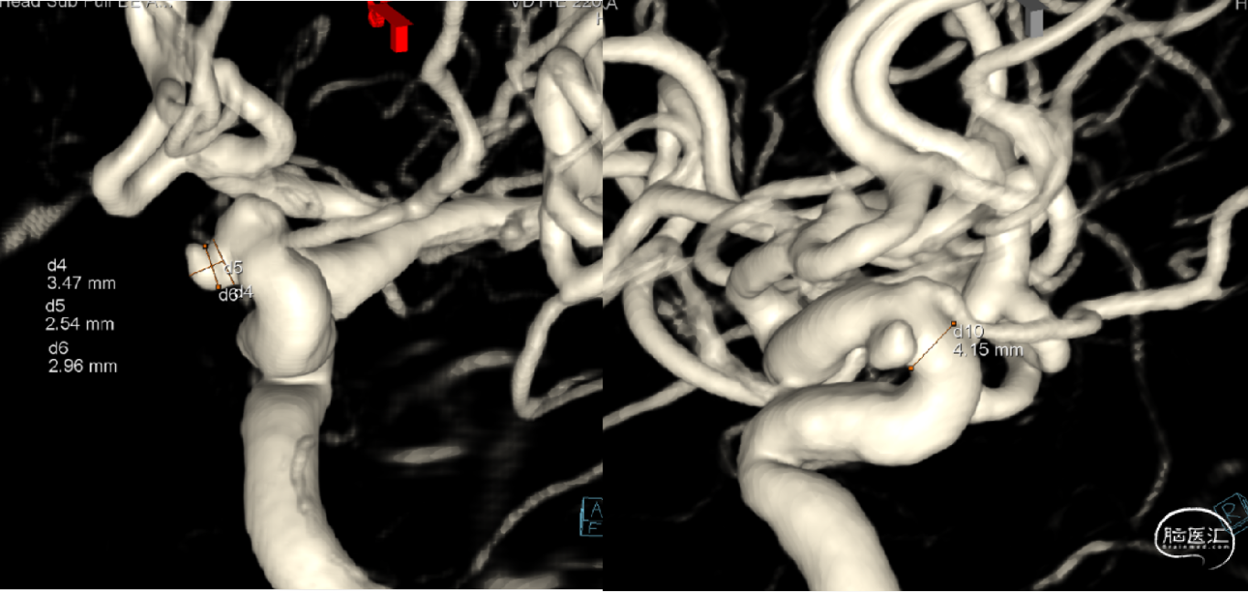 e447f5bdbe5eb19419ecbb9a8e4b75ff.png