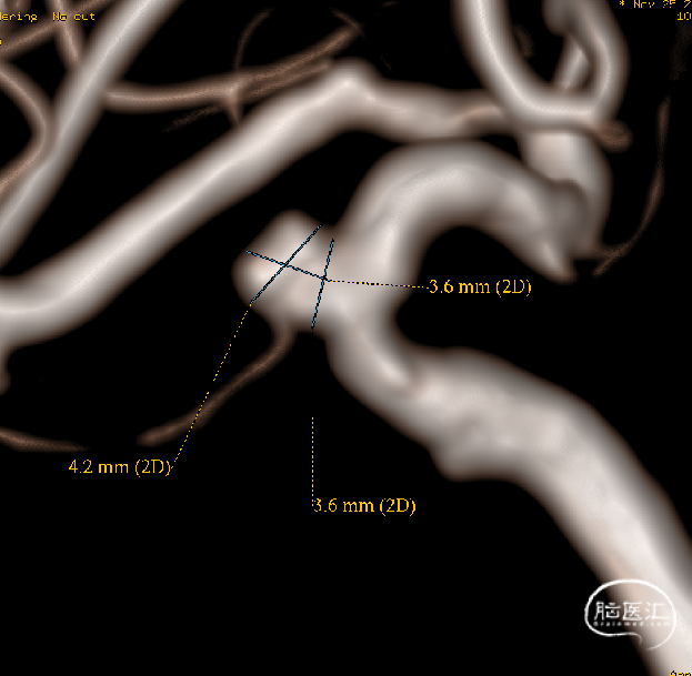 df5405df3ef28629128100a871aa10c4.png