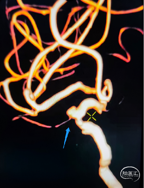 2ab6ef19398069b2185110bfb35b7a0d.png
