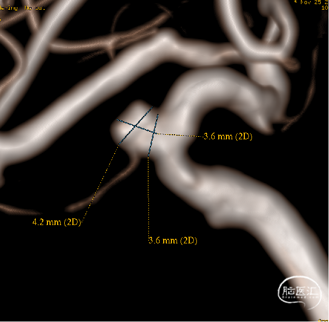 5d3814daed3db591353815b0592e484a.png