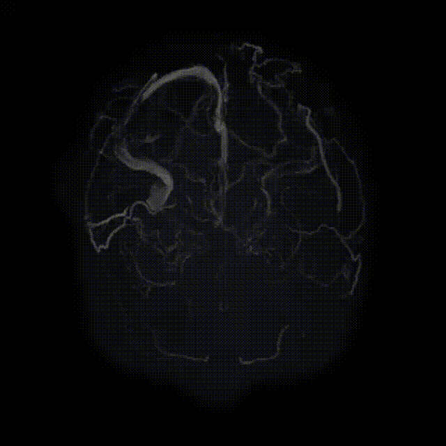 视频2 00_00_00-00_00_30.gif