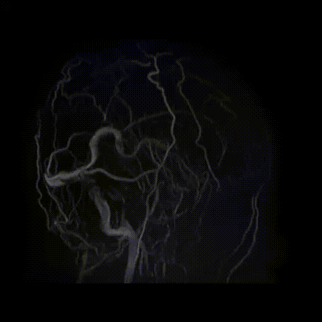 视频1 00_00_00-00_00_30.gif