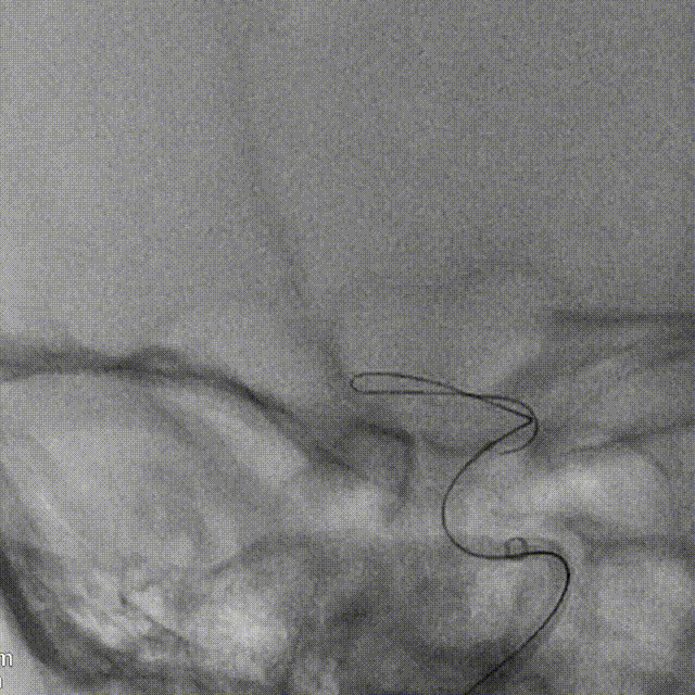 media5 00_00_00-00_00_30.gif