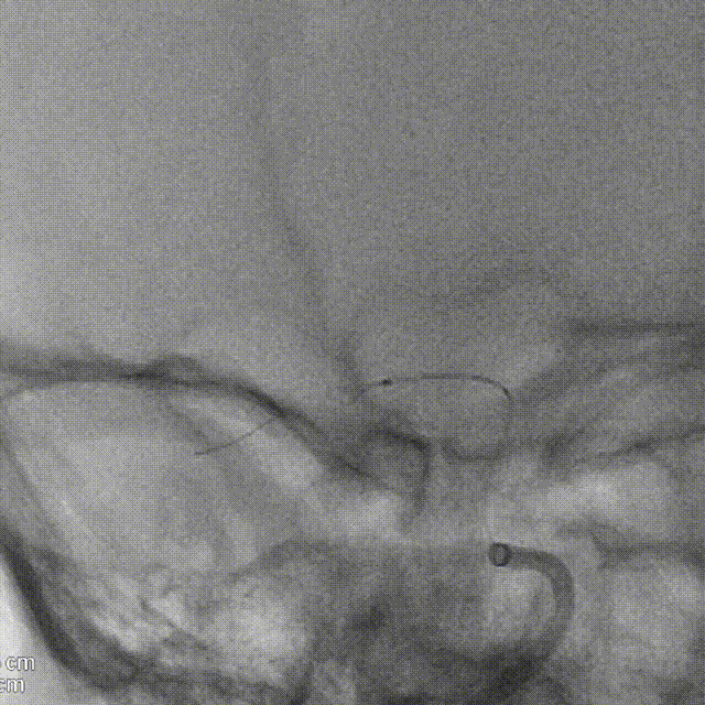 media2 00_00_00-00_00_30.gif