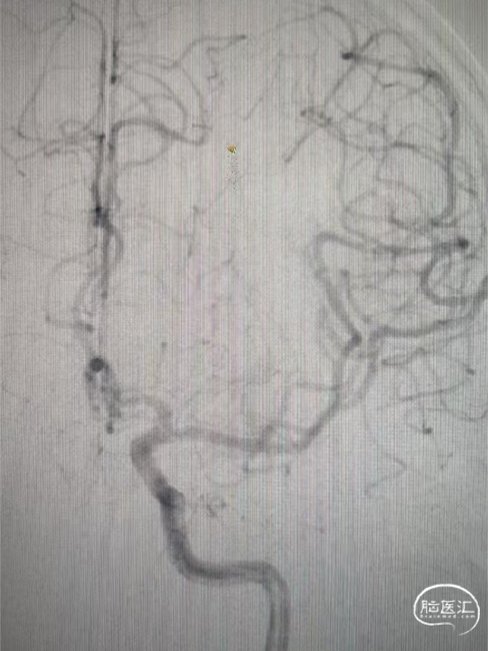 image11.png