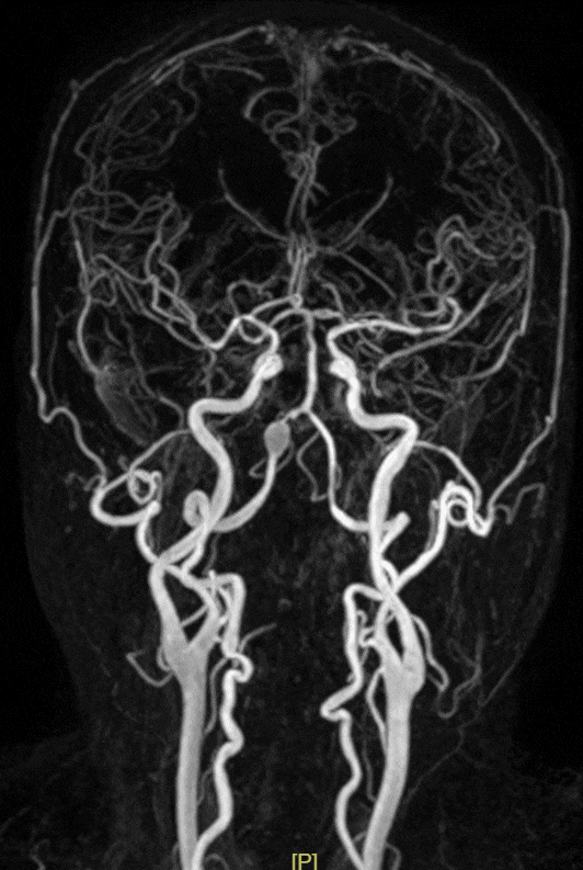 image1.GIF