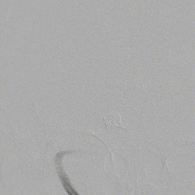 media14 00_00_00-00_00_30.gif