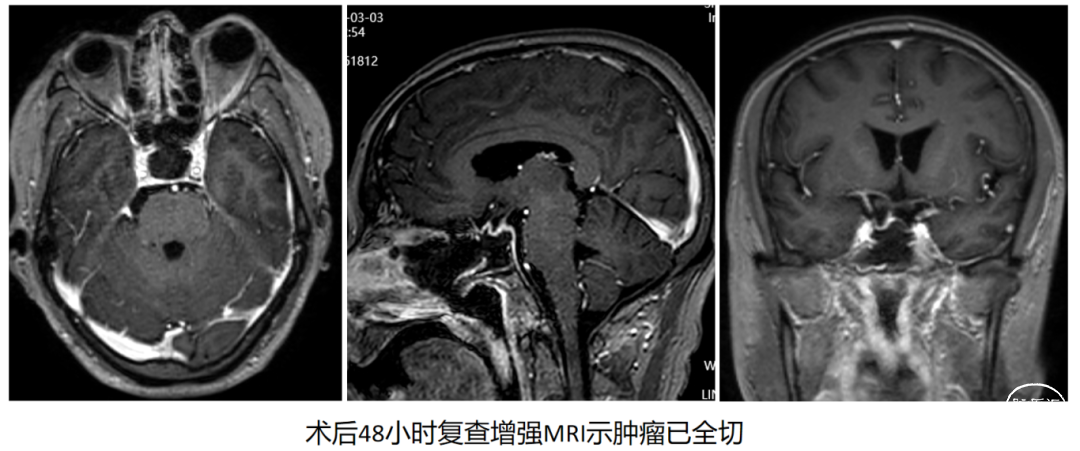 317f93ec-47b0-4a4a-b8ea-833f8612bcc2.png