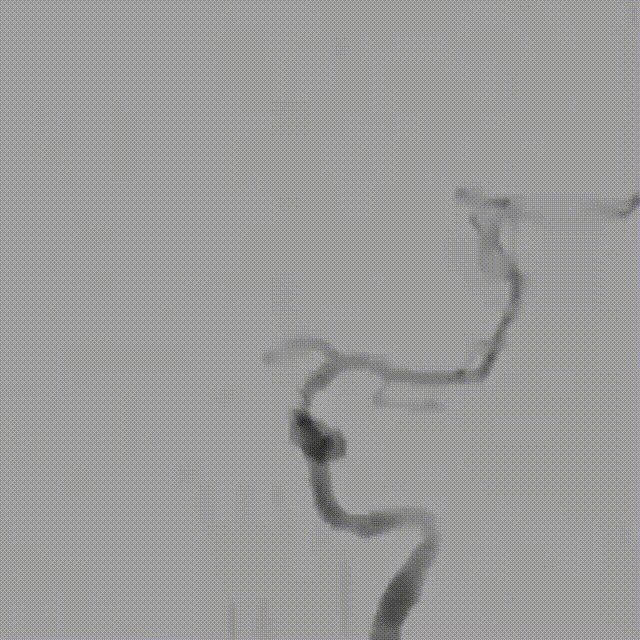 media11 00_00_00-00_00_30.gif
