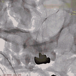 ppt29-1.gif
