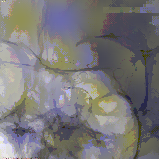 ppt12-1 00_00_00-00_00_30.gif