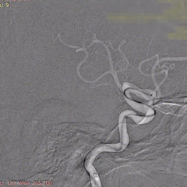 ppt7-2 00_00_00-00_00_30.gif