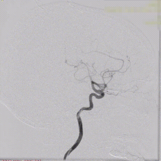 ppt4-3 00_00_00-00_00_30.gif