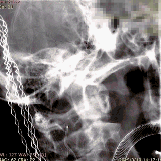 ppt26-2.gif