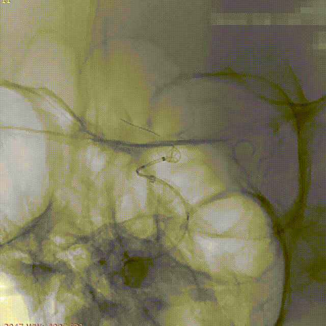 ppt10-1 00_00_00-00_00_30.gif
