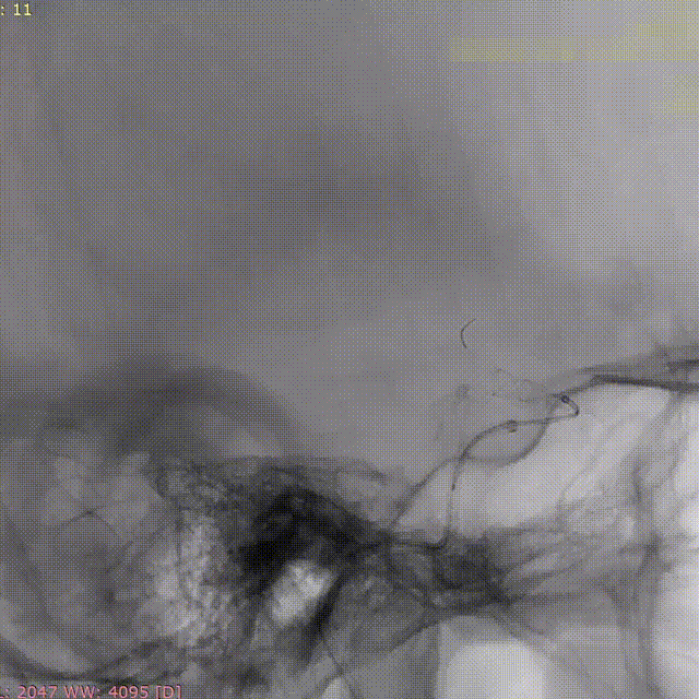 ppt10-2 00_00_00-00_00_30.gif