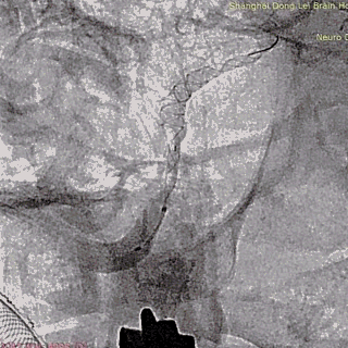 ppt41-1.gif